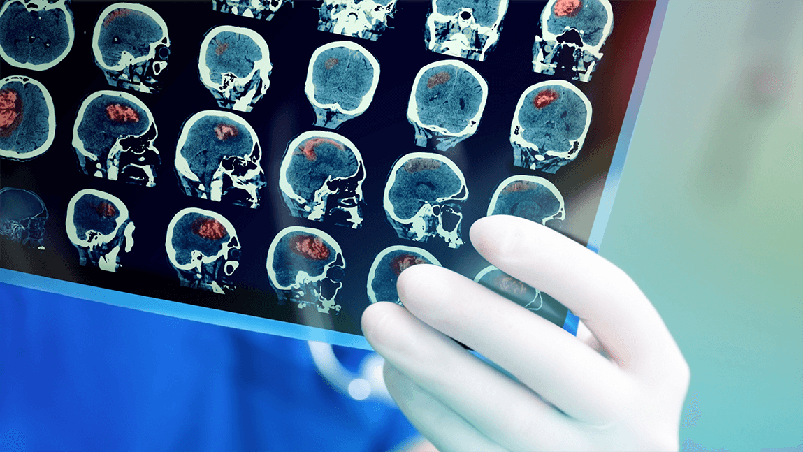 Doctor holding MRI images