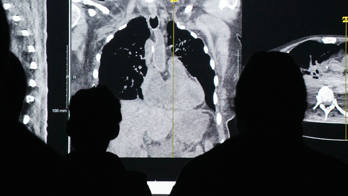 People standing in front of lung medical images