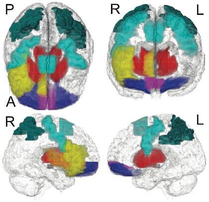 brain networks