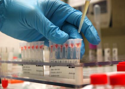 blood testing
