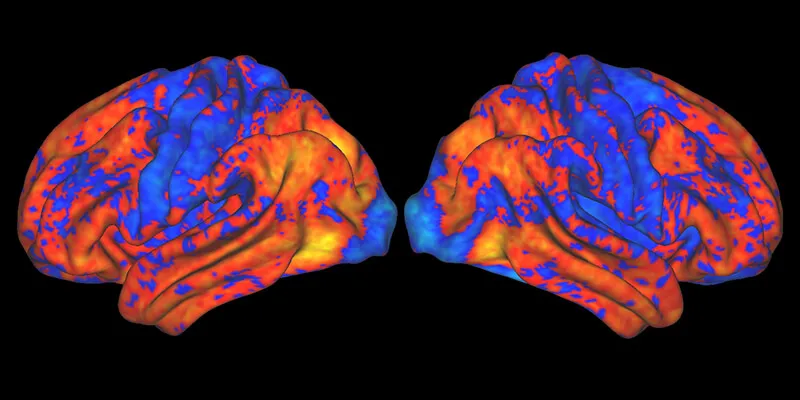 Two sides of a brain scan, blue with patches of red