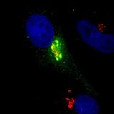 Image of lab data