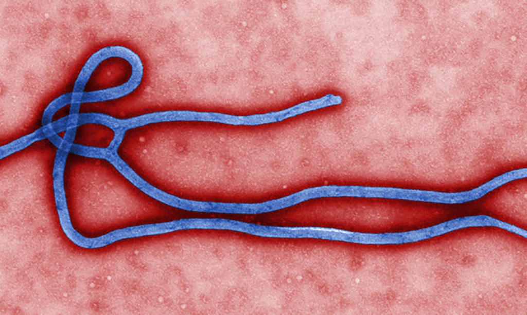 ebola