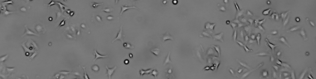 lung cells under 400X magnification