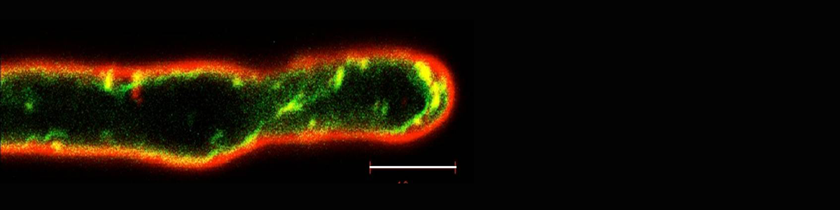 Tierney Lab Confocal Image