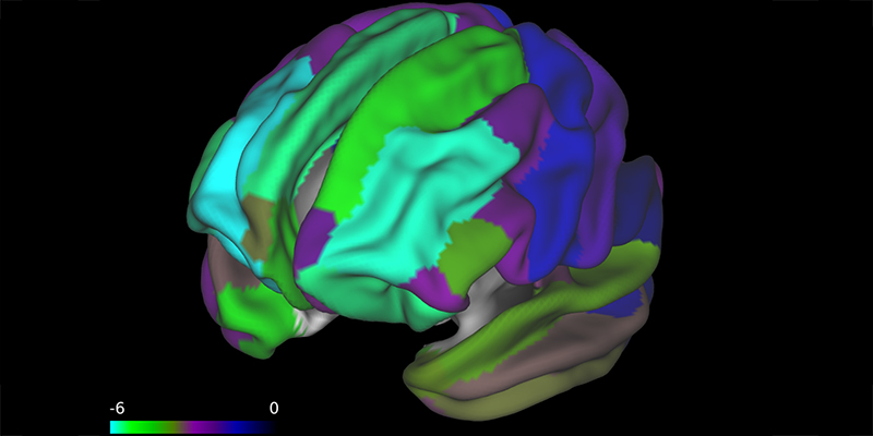 image of a brain scan