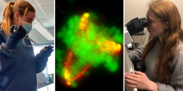 Collage of Lisa Wood, pipetting with test tube in lab; a breast cancer cell; and Carolyn Marquis, staring into microscope