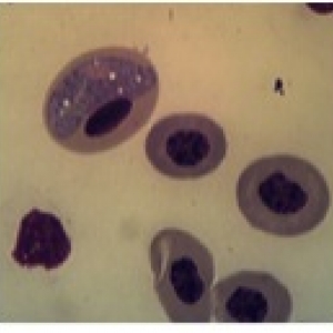 Cells under the microscope