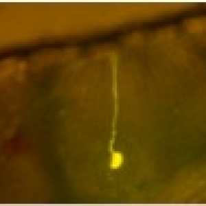 Closeup under a microscope