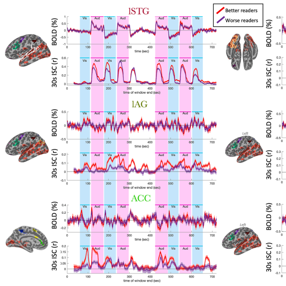 NeuroImage2023 Article