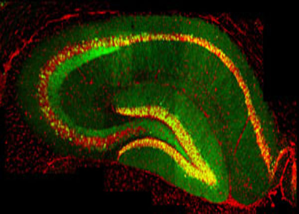 research image